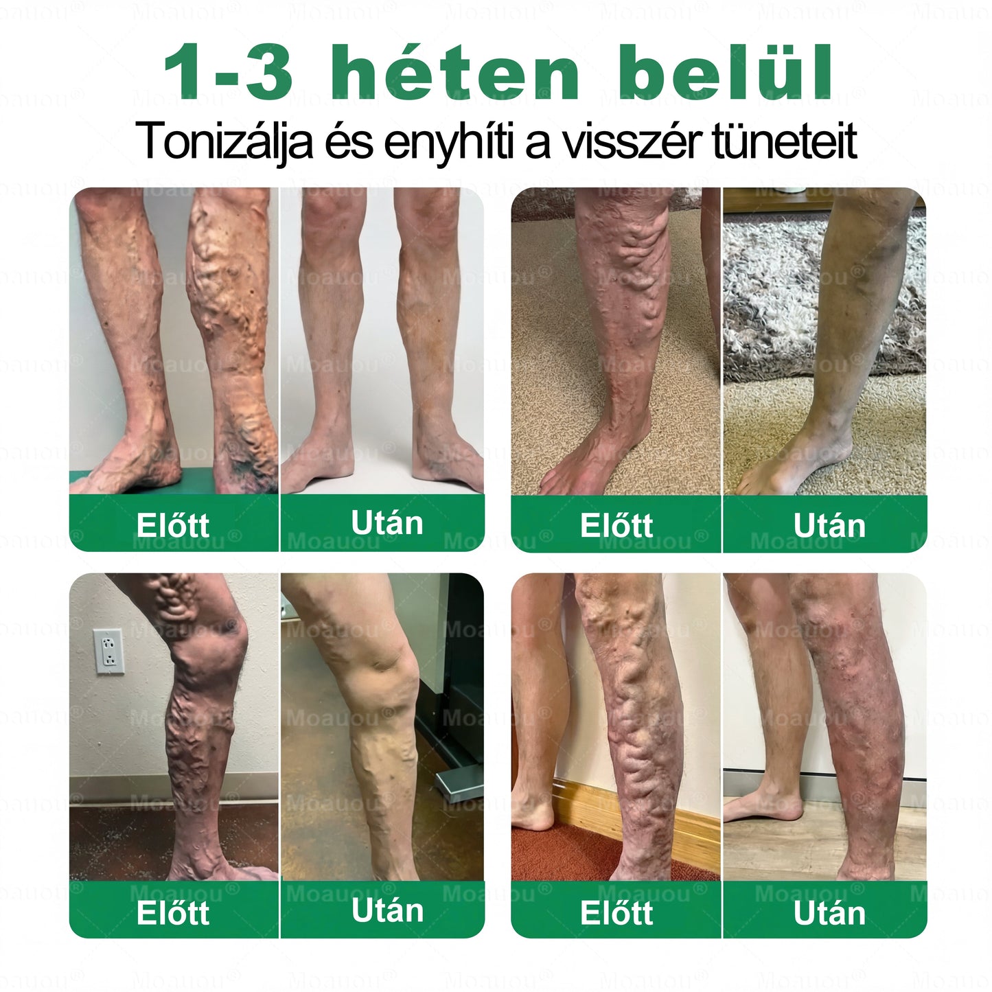 🎁Moauou® Csak 5 doboz maradt! További 50% kedvezmény! Erősítsd meg a tested, élj egészségesen. Ne habozz, ha most nem cselekedsz, jövőre már nem lesz lehetőséged!