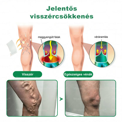 🎁Moauou® Csak 5 doboz maradt! További 50% kedvezmény! Erősítsd meg a tested, élj egészségesen. Ne habozz, ha most nem cselekedsz, jövőre már nem lesz lehetőséged!
