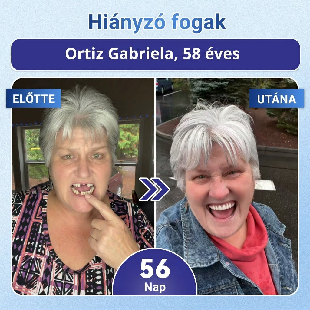 🦷 Mondj búcsút az érzékenységnek és kellemetlenségeknek! 𝐂𝐨𝐚𝐮𝐨𝐨® Tideglusib szájcsíkok – gyors regenerálás a fogaknak és az ínynek 😊