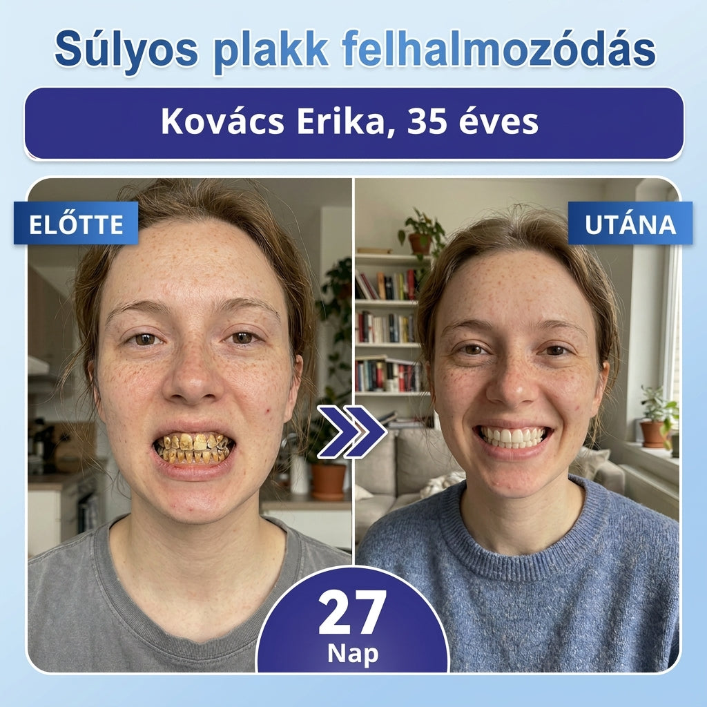 🦷 Mondj búcsút az érzékenységnek és kellemetlenségeknek! 𝐂𝐨𝐚𝐮𝐨𝐨® Tideglusib szájcsíkok – gyors regenerálás a fogaknak és az ínynek 😊