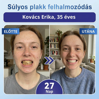 🦷 Mondj búcsút az érzékenységnek és kellemetlenségeknek! 𝐂𝐨𝐚𝐮𝐨𝐨® Tideglusib szájcsíkok – gyors regenerálás a fogaknak és az ínynek 😊