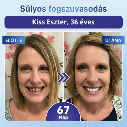 🦷 Mondj búcsút az érzékenységnek és kellemetlenségeknek! 𝐂𝐨𝐚𝐮𝐨𝐨® Tideglusib szájcsíkok – gyors regenerálás a fogaknak és az ínynek 😊