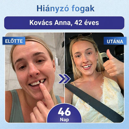 🦷 Mondj búcsút az érzékenységnek és kellemetlenségeknek! 𝐂𝐨𝐚𝐮𝐨𝐨® Tideglusib szájcsíkok – gyors regenerálás a fogaknak és az ínynek 😊