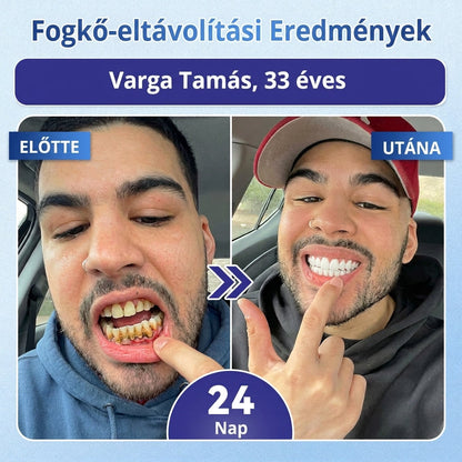 🦷 Mondj búcsút az érzékenységnek és kellemetlenségeknek! 𝐂𝐨𝐚𝐮𝐨𝐨® Tideglusib szájcsíkok – gyors regenerálás a fogaknak és az ínynek 😊