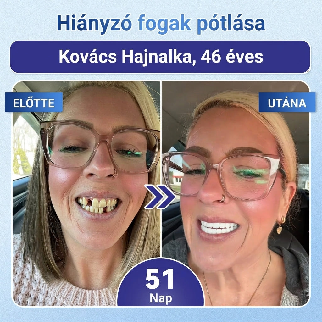 🦷 Mondj búcsút az érzékenységnek és kellemetlenségeknek! 𝐂𝐨𝐚𝐮𝐨𝐨® Tideglusib szájcsíkok – gyors regenerálás a fogaknak és az ínynek 😊
