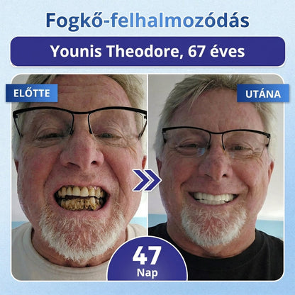 🦷 Mondj búcsút az érzékenységnek és kellemetlenségeknek! 𝐂𝐨𝐚𝐮𝐨𝐨® Tideglusib szájcsíkok – gyors regenerálás a fogaknak és az ínynek 😊